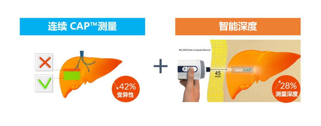 APASL2023 | SmartExam by FibroScan?在NAFLD中的应用优势