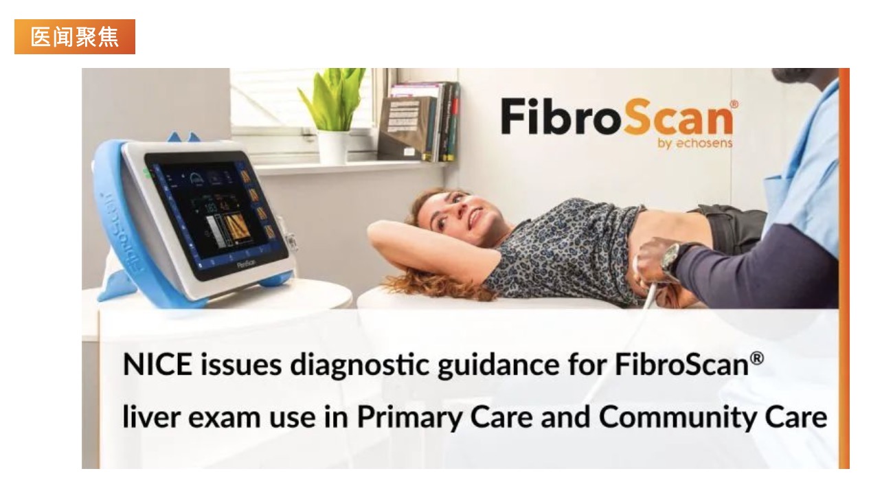 医闻聚焦 | NICE发布具有里程碑意义的指导意见，将常规肝脏扫描引入初级保健机构